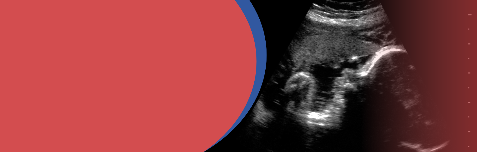 Fetal Well-being Scan at 32-36 Weeks, highlighting baby health, growth, and placental function in late pregnancy.