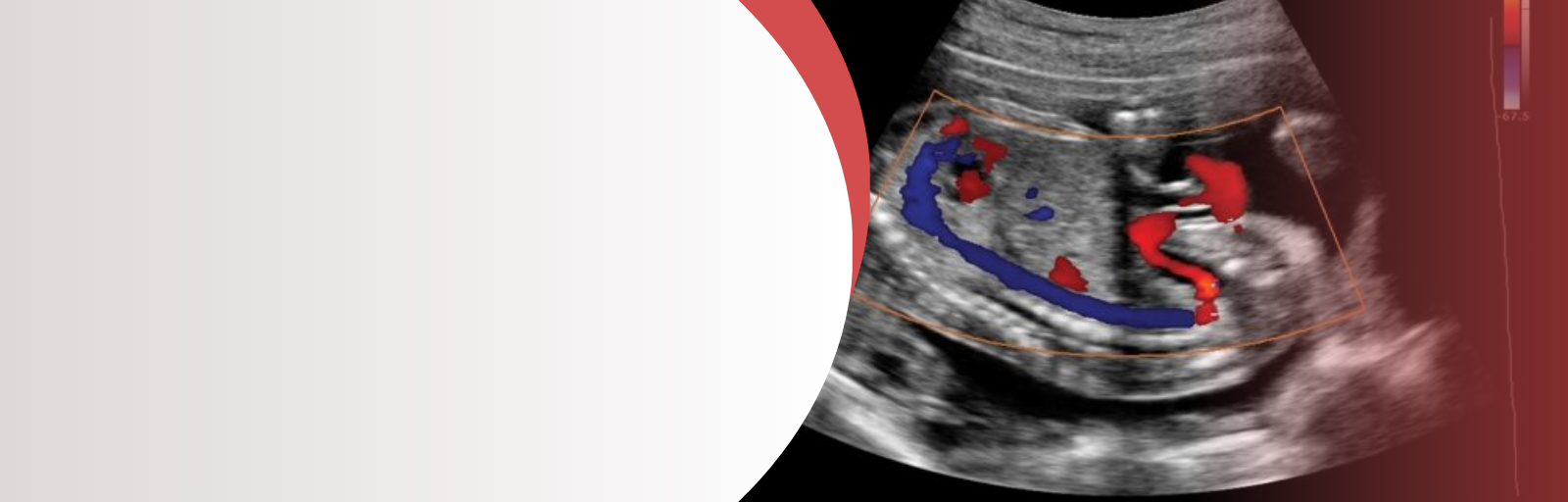 A Fetal Doppler Ultrasound Imaging of Fetal Blood Flow